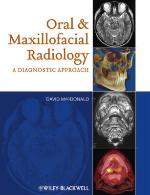 Oral and Maxillofacial Radiology. A Diagnostic Approach - David  Macdonald 