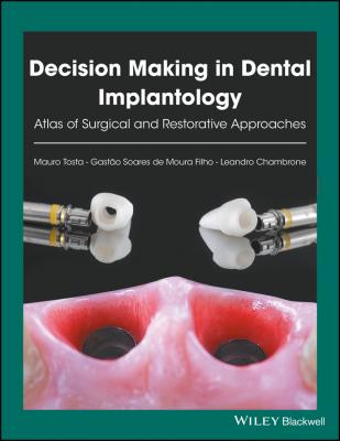 Decision Making in Dental Implantology. Atlas of Surgical and Restorative Approaches - Leandro  Chambrone 
