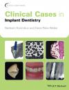 Скачать Clinical Cases in Implant Dentistry - Nadeem  Karimbux