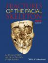 Скачать Fractures of the Facial Skeleton - Andrew  Brown