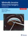 Скачать Minimally Invasive Glaucoma Surgery - Brian  Francis