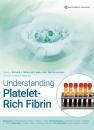 Скачать Understanding Platelet-Rich Fibrin - Richard J. Miron