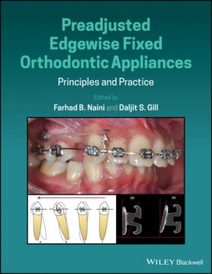 Preadjusted Edgewise Fixed Orthodontic Appliances - Группа авторов 