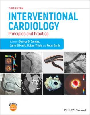 Interventional Cardiology - Группа авторов 