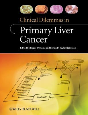 Clinical Dilemmas in Primary Liver Cancer - Williams Roger 