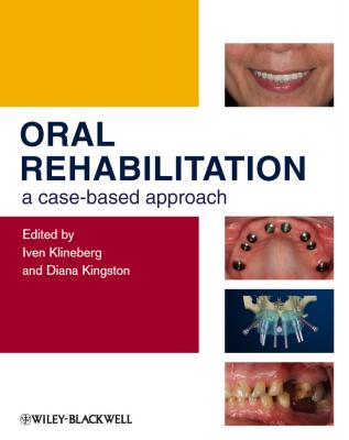 Oral Rehabilitation. A Case-Based Approach - Klineberg Iven 