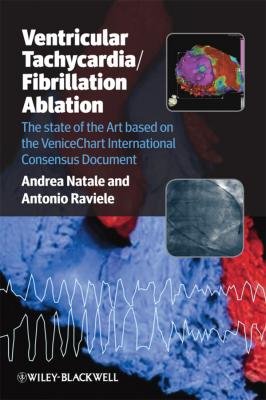 Ventricular Tachycardia / Fibrillation Ablation. The state of the Art based on the VeniceChart International Consensus Document - Raviele Antonio 