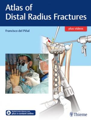 Atlas of Distal Radius Fractures - Francisco del Piñal 