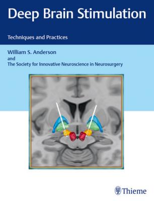 Deep Brain Stimulation - William S. Anderson 