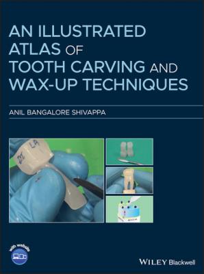 An Illustrated Atlas of Tooth Carving and Wax-Up Techniques - Anil Bangalore Shivappa 