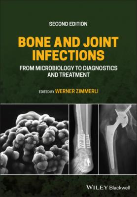 Bone and Joint Infections - Группа авторов 
