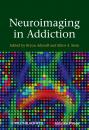 Скачать Neuroimaging in Addiction - Adinoff Bryon