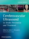 Скачать Cerebrovascular Ultrasound in Stroke Prevention and Treatment - Hacke Werner