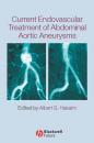 Скачать Current Endovascular Treatment of Abdominal Aortic Aneurysms - Группа авторов