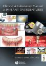 Скачать Clinical and Laboratory Manual of Implant Overdentures - Группа авторов