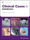 Скачать Clinical Cases in Endodontics - Группа авторов