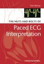 Скачать The Nuts and bolts of Paced ECG Interpretation - Группа авторов